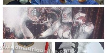نجاح أول جراحة معقدة بمفصل الحوض في مستشفى بركة السبع بالمنوفية - عرب فايف