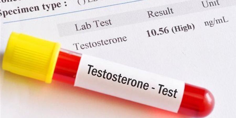خبراء يحذرون من الترويج العشوائي لمكملات “هرمون الذكورة” - عرب فايف