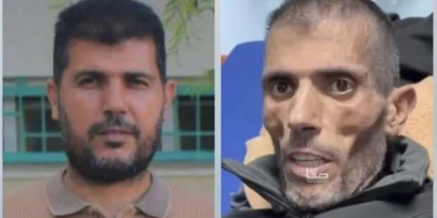 «بقى هيكل عظمي».. صور لفلسطيني قبل وبعد الإفراج عنه من سجون إسرائيل: تعذيب لا يوصف - عرب فايف